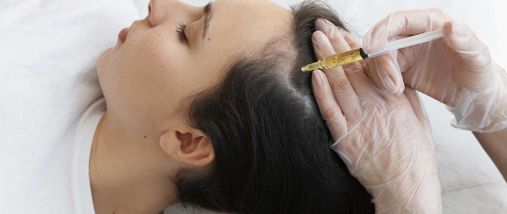 GFC Hair Fall Treatment