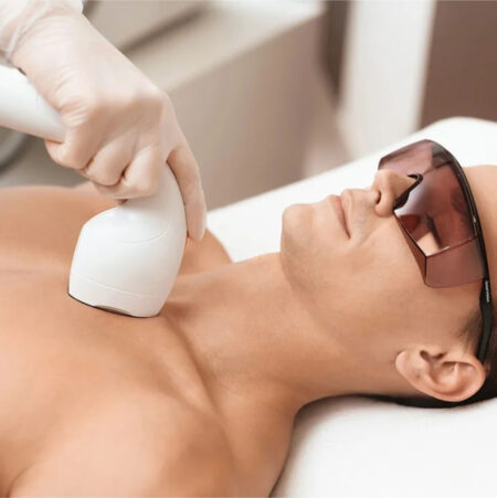 Full Body Laser Hair Reduction - Image 3