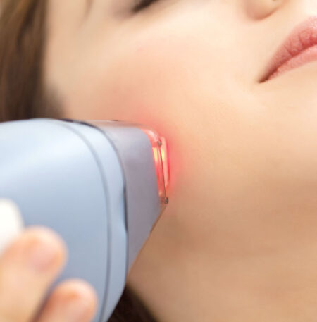 Full Body Laser Hair Reduction - Image 2
