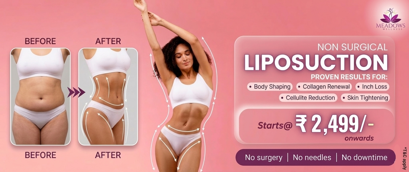 Non Surgical Lipo Suction