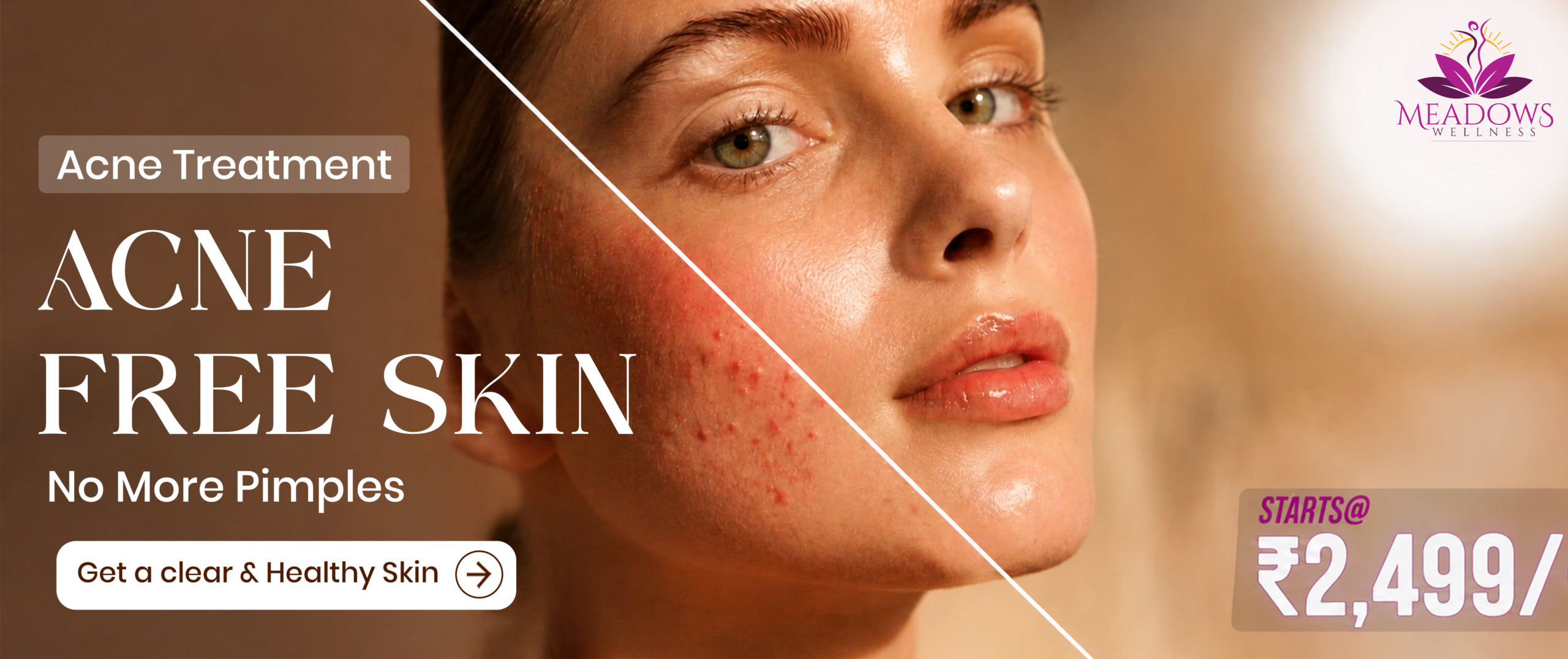 Skin Treatment