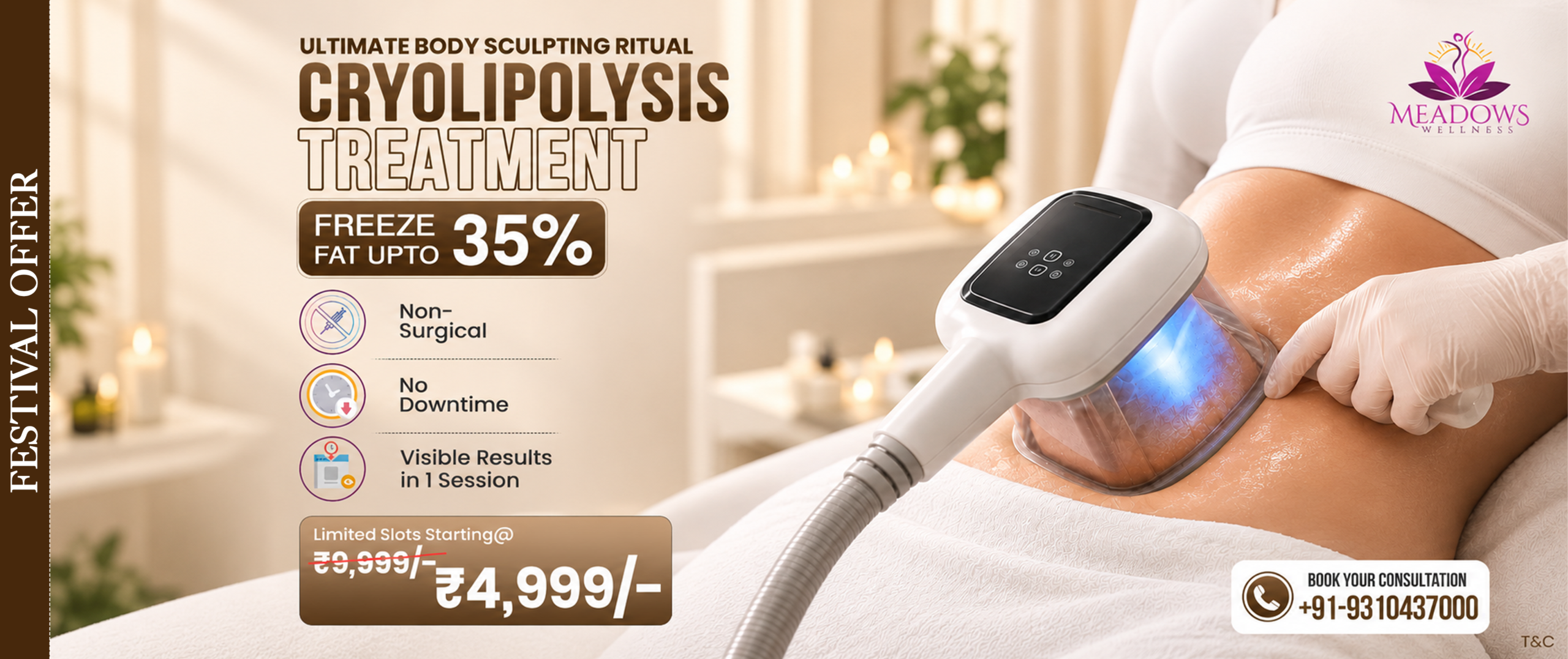 Cryolipolysis